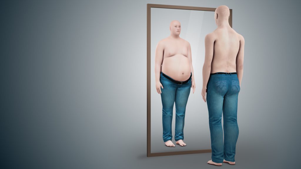 body dysmorphic disorder1